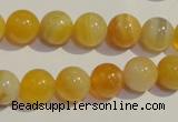 CAA91 15.5 inches 14mm round botswana agate gemstone beads